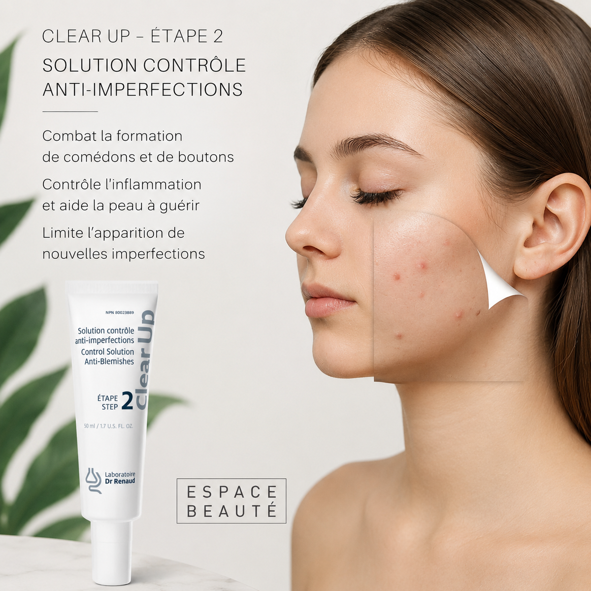 Clear Up #2 Solution anti-imperfections